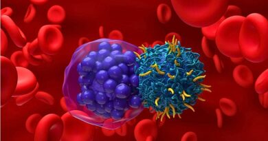 Científicos desarrollan una terapia celular de bajo coste que reduce el tiempo de tratamiento de semanas a 72 horas, con resultados prometedores en mieloma múltiple